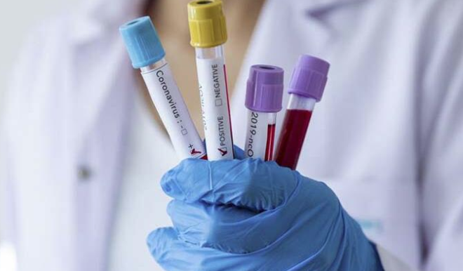 A yaplacak vatandalardan, kendi rzasyla a olduuna dair "Onam belgesi" alnacak. Uzmanlar, dier alarda alnmayan bu belgenin koronavirs as iin mecburi tutulmasnn sebebini ise yle aklyor: Salgn dneminde acil olarak uygulamaya koyduun bir ay vuruyorsun...