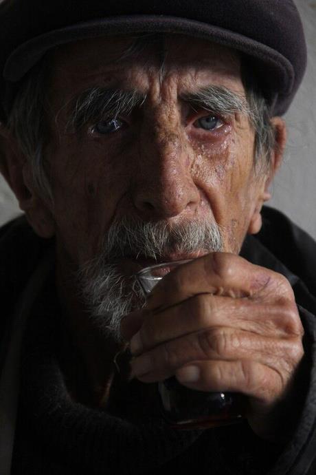 Yaradan?n souktan ya da yalla bal olarak lm olabilecei zerinde duruluyor.