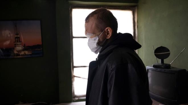 Yzn srekli sargda tutmak zorunda kalan Ylmaz, unlar syledi:    ''Suratm, burnum, dudaklarm ve damam yok. Daha nce grebiliyordum, ama u an sol gzm de kaybettim. Sa gzmle de sadece biraz  grebiliyorum. Her zaman Allah'a krettim. Kzm grebildiim iin krettim. Ama u an kzm da gremiyorum. Grme yeteneimi de kaybedince psikolojim bozuldu.''