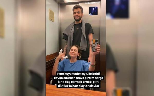 Ardndan takipilerinden gelen mesajlara kaytsz kalmayan Farah Zeynep Abdullah, "Gemi olsun dilekleriniz iin ok teekkrler. ki kpeim ciddi kavga etti, zar zor ayrdm. O karmaa srasnda baya darbe aldm. Baya kopuyormu ba parmam. Trnak sallanyordu. Avucumda tutarak gittim hastaneye ya, ok oldum. Sere de yarlm, krlm. nanamyorum hala..." dedi.