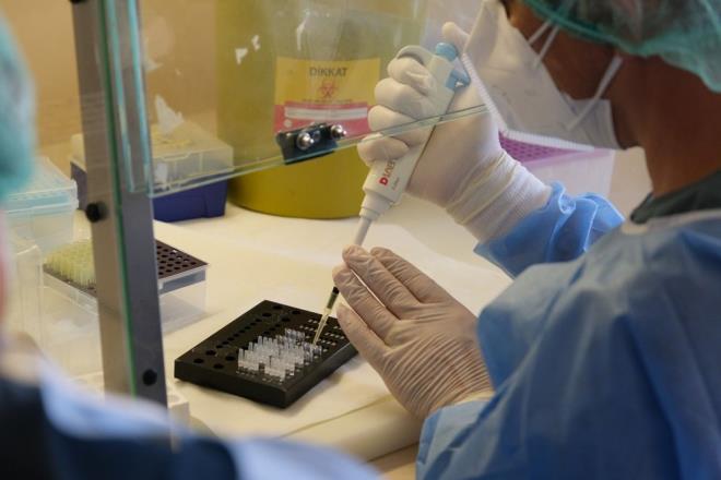 Uygulanan bilimsel almann sonular kamuoyuyla paylald. Aratrma sonularna gre antikoru negatif olan, bir ay arayla iki doz Sinovac as yaplan bin 53 salk alanndan 26 kii Covid-19'a yakaland.     nc ayda baklan Covid-19 antikor dzeylerinde azalma beklenirken ar dzeyde ykselmi olan drt kiinin de, semptomsuz (belirtisiz) Covid-19 geirdii hesaba katlarak 2 doz Sinovac as sonras hastalanan salk alan says toplamda 30 (yzde 2.8) olarak saptand.