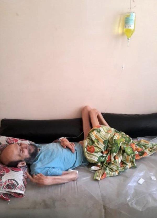 77 yandaki usta oyuncunun ileri yala beraber yeme bozukluu ve sv elektronik dengesizlii sebebiyle kilo kayb yaad ve bilincinin ak olduu bildirilmiti.