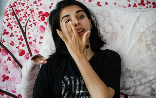 Et ban ald: Masa, sehpa ne bulduysa krd. Artk yeter dedim, 'Benden ayrlacaksn deil mi?' dedi. 'Ayrlacam' dememe kalmad, darp etti. Yzm gzm tannmayacak hale gelene kadar darp etti. Mutfaktan et ban ald. Ben lk la bardm, kimse polisi aramad.