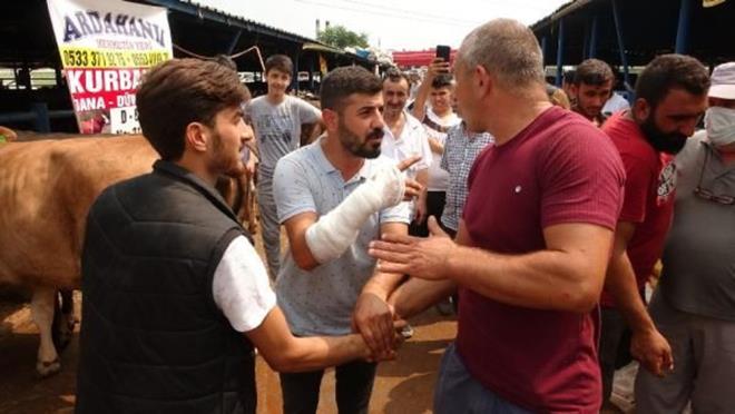 Kahraman, son olarak unlar kaydetti:    "Hastaneye gittim, atlak var dediler. Kolum sarl pazara gelince esnaf glmeye balad. Sosyal medyadan bu olay grenler ard, e dost herkes arad.?