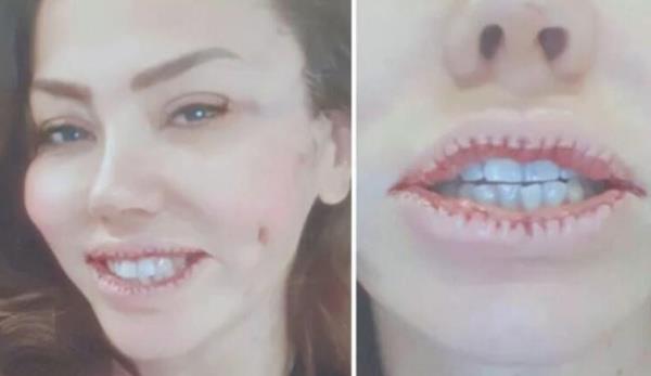 Pandemi srecinde sk bir sosyal medya kullancs olan Lara, yaynlad gnderi ile adndan sz ettirmiti.   <br>    Gzyalar iinde piman olduunu syleyen arkc, dudaklarn hareket ettirmekte zorlandn ifade etmiti.