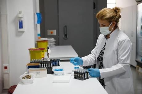 "150 bin test kapasitesine ulatk"  <br>  Pandeminin ilk balad Mart 2020'den bu yana her adan ok yol kat edildiini syleyen Do. Dr. Kazezolu, "Biz stanbul'da 2020 16 Mart tarihinde, gnde 300-400 test kapasitesiyle alabiliyorduk. Ama bugn, zel sektr de dahil ettiimiz zaman 120-150 bin aras gnlk PCR testi yapabilir durumdayz. Sonu verme srelerimize de yansd bu durum. u anda Kovid PCR test sonularn maksimum 9 saatte verebiliyoruz ki, bu en yksek sremiz. Ortalama 5-6 saat civarnda sonulandrm oluyoruz. retmenlerin ya da eitim personelinin bu gruba dahil olmas, bu sreyi arttrmayacak. Gerekirse personel oaltarak ve aksiyon tedbirlerini alarak yine ayn sreler ierisinde sonular verebiliriz" eklinde konutu.