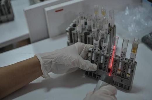 Stadyumlar, konser alanlar, yolculuk durumlarnda da asz olanlarn PCR negatifliini gstermek durumunda olacan belirten Do. Dr. Kazezolu, yurt dnda bu gibi durumlarda tarama testi olarak PCR yerine hzl antijen testlerinin kullanmyla ilgili tartmalar hakknda da unlar syledi: "Evet, yurt dnda PCR dnda hzl antijen testlerinin kullanldn biz de okuyoruz. Baz lkelerde artk tan algoritmasnn iine bu tarama testlerinin de alnd ynnde bilgiler var.