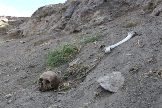 Kyn hemen ierisinde bulunan hyn etrafnda bulunan kemiklere uzun sredir mdahale edilmedi.