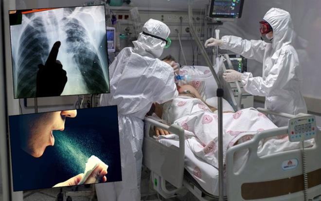 Koronavirs sebebiyle pek ok rutin doktor kontrol aksad. Hastalar polikliniklere geri dndklerinde tberkloz (verem) saylarnda art grld.