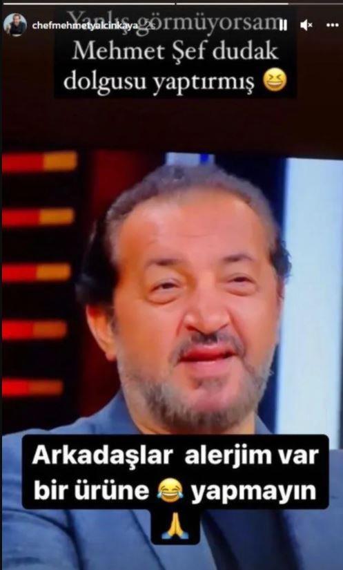 "Arkadalar alerjim var bir rne. Yapmayn ltfen!"  <br>  Bir sosyal medya hesab dudak dolgusu iddiasnda bulununca Mehmet Yalnkaya aklama geldi. MasterChef jri yesi Yalnkaya aklamasnda "Arkadalar alerjim var bir rne. Yapmayn ltfen!" ifadelerini kulland.