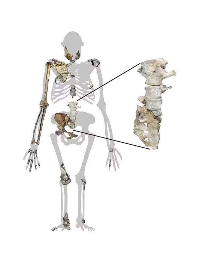 Bununla birlikte, Australopithecus sediba ilk olarak 2010 ylnda Witwatersrand niversitesi'nde Prof. Dr. Lee Berger ve ekibi tarafndan tanmland. Son fosiller, Johannesburg'un kuzey batsnda, "nsanln Beii Dnya Miras Alan"ndaki Malapa blgesinin yanndan geen bir maden yolunun kazlar srasnda 2015 ylnda bulundu.