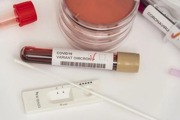 Aratrmaclar Omicron'un endie verici mutasyonlarnn onu deltadan daha bulac hale getirip getiremeyeceini ve alara kar direncin gerek dnyaya etkileyip etkilemeyeceini anlamak iin en az iki haftaya daha ihtiyalar olduunu syledi.