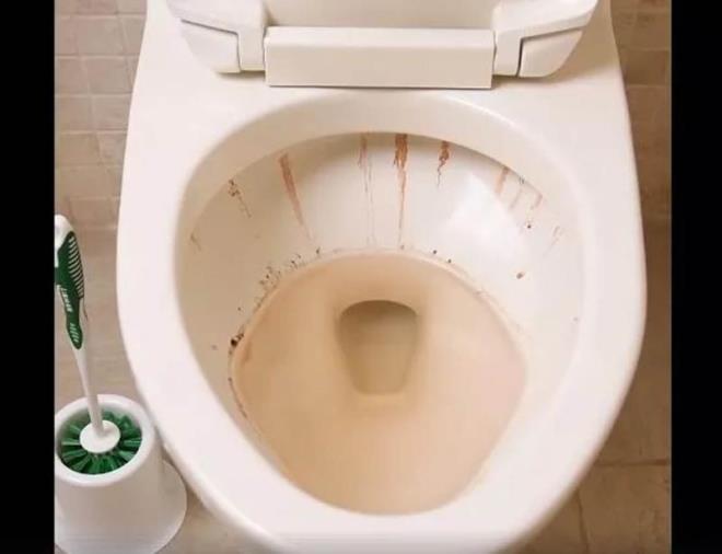 4- Klozetlerde oluan lekeler sizi de rahatsz ediyor mu?