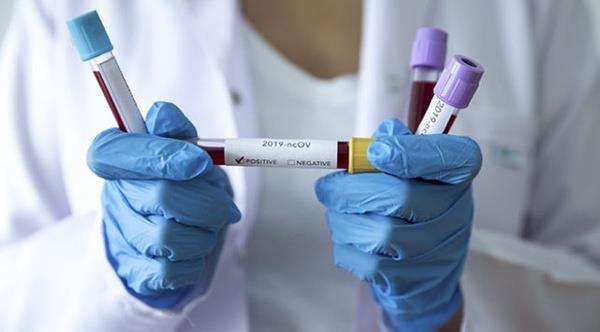 Aratrmada yer alan Dr. Vivek Ranjan ise, ?Kan grubu B olan erkekler, kan grubu B olan kadnlara gre hastala kar daha dayanksz. Kan grubu AB olan 60 ya zerindeki hastalarn da enfeksiyon riski daha yksek? dedi.