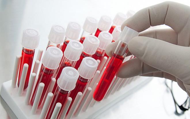 Hindistan?n bakenti Delhi?deki Sir Ganga Ram Hastanesi?nde yaplan bir aratrma kan gruplar ile Covid-19?un ban mercek altna ald.