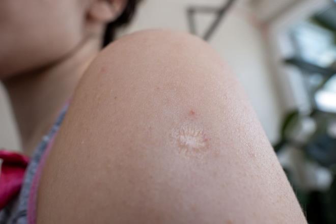 NIHR Southampton Klinik Ara�t�rma Tesisi klinik ba� ara�t�rmac�s� ve direkt�r� Saul Faust geli�tirilen i�nesiz a�� ile ilgili, "Bu teknoloji, d�nya �ap�nda �ok say�da insana geni� kapsaml� koruma sa�layabilir" diye konu�tu.