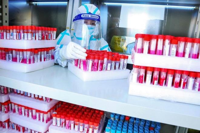 Dr. Chan ile birlikte virsn kkenleri hakknda bir kitap yazan Lordlar Kamaras yesi Matt Ridley ise,, uzmanlarn iki yllk aratrmaya ramen doal bir kkeni destekleyecek hayvan konaksn hala bulamadklar gereinin corona virsn laboratuvarda oluturulduu fikrini glendirdiini aktard.