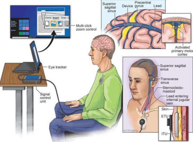 ?BLGSAYARDA NEREYE TIKLAMAK STEDM DNMEM YETYOR?    lk tweet, ?Tu vurularna veya seslere gerek yok. Bu tweeti sadece dnerek oluturdum? eklinde olurken, O'Keefe daha sonra sorulan sorulara yant olarak dnce gcyle 7 tweet daha att.