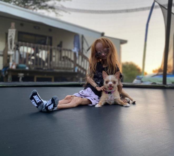 Costello, "Kalbim krk. Dn gece saat 19.00'da bir mesaj aldm, Adalia Rose Williams Tanr'ya arld. zntm anlatacak kelimeleri bulamyorum ve alamay durduramyorum. Adalia, tant her insan iin ok zeldi.