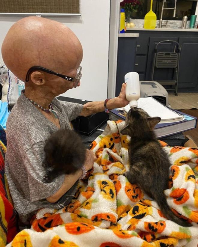 Dier taraftan, Williams?n annesi Natalia Pallante, 2018 ylnda NZ Herald'a verdii demete, Williams'a yalanmay hzlandran ve ortalama yaam beklentisi 13 yl olan nadir bir genetik hastalk tehisi konduunda onun  aylk olduunu sylemiti.