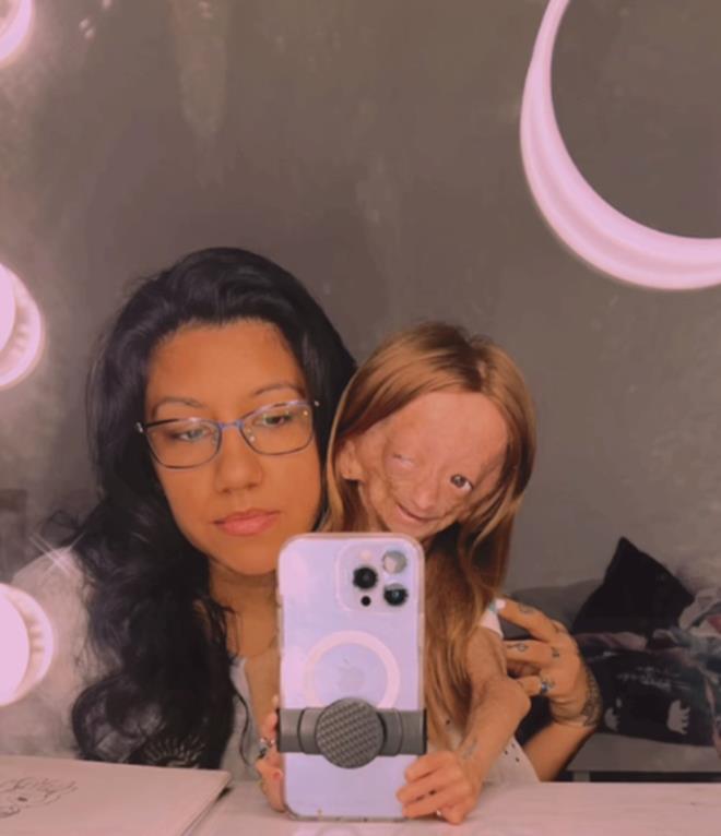 "MLYONLARCA NSANIN HAYATINA DOKUNDU"    ?Dnyaya sessizce geldi ve aramzdan sessizce ayrld, ama hayat bundan ok uzakt. Milyonlarca insana dokundu ve onu tanyan herkeste byk bir iz brakt. Artk ac ekmiyor ve sevdii tm mziklerle dans ediyor. Gerekten bunun bizim gereimiz olmamasn dilerdik. Ama ne yazk ki yle. Onu seven ve destekleyen herkese teekkr etmek istiyoruz.?