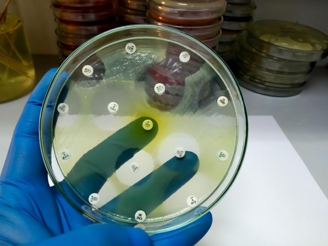 ngiltere'nin antimikrobiyal diren zel temsilcisi Dame Sally Davies, AMR'nin "insanln kar karya olduu en byk zorluklardan biri" olduunu belirterek. ?Bu yeni saylarn arkasnda, sessiz AMR salgnnn ykn trajik bir ekilde tayan aileler ve topluluklar var. Bu verileri her dzeyde harekete gemek iin bir uyar sinyali olarak kullanmalyz? dedi.