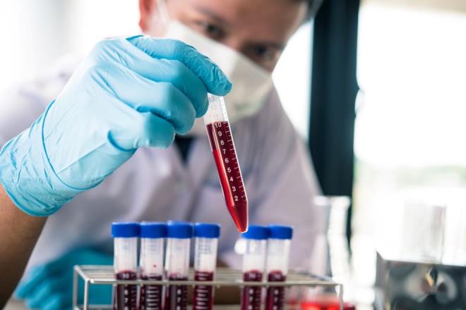 almada, kiilerin kanlarnda yksek dzeyde apolipoprotein (LPA) ve vaskler hcre adezyon molekl 1 (VCAM1) bulunan kiilerin genellikle daha ksa yaam srd tespit edildi.    Aratrmay gerekletiren ekip, kandaki bu protein seviyelerini azaltabilecek ilalarn veya dier tedavilerin gelitirilmesinin insanlarn daha uzun, daha salkl yaamalarna yardmc olabileceine inandklarn aktard.