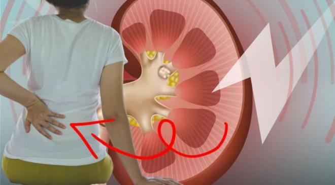 imdilerde gnmzde 2.4 milyon kiide grlen kronik bbrek hastalklar 2030 ylnda yaklak 5 milyona ulaaca konusunda uzmanlar uyarda bulundu. Acbadem niversitesi Tp Fakltesi Nefroloji Bilim Dal Bakan ve Acbadem International Hastanesi Bbrek Nakli Merkezi Nefroloji Sorumlusu Prof. Dr. lkem akr, vcutta bozulan bbrek fonksiyonlarnn bir hastalk akabinde ya da bir hastalk sonras yaanabileceinin altn izdi.