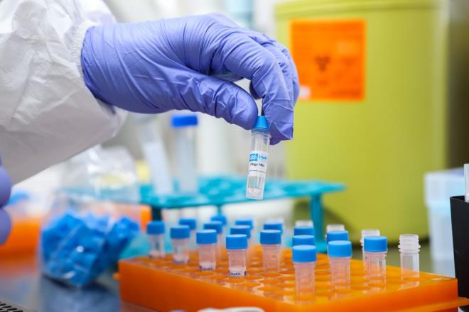 Kitin patentini almak iin 8 ay nce bavuruda bulunduklarn belirten Akdoan, ilk aratrma raporlarnn son derece olumlu geldiini, yaknda rnn patentlenebilecei konusunda ciddi umutlar olduunu ifade etti.