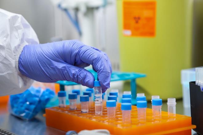 Prof. Dr. Erhan Akdoan, kit almalarnn ve retiminin TSEB-Trkiye Biyoteknoloji Enstits'ndeki aratrmac ve akademisyenler tarafndan Biyoteknolojik la ve A Ar-Ge Eitim Merkezi'ndeki laboratuvarlarda yapldn belirterek, "u anda manuel olarak bu kitlerin retimini gerekletiriyoruz. Yksek saylarda talep edildii zaman, bunlar belli otomasyon ve robotik sistemlerle beraber ok ok yksek saylara da ulaabiliyor." bilgisini verdi.