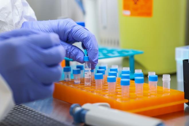 Trkiye Salk Enstitleri (TSEB) Bakan Prof. Dr. Erhan Akdoan, milli imkanlarla gelitirilen, duyarllk, tm cihazlarda alma ve farkl varyantlarn tamamnda tan yapabilme zellikleri bulunan yerli Covid-19 tan kiti "TSEB DiaKit"in, 11 Nisan Pazartesi gnnden itibaren kullanma sunulacan bildirdi.