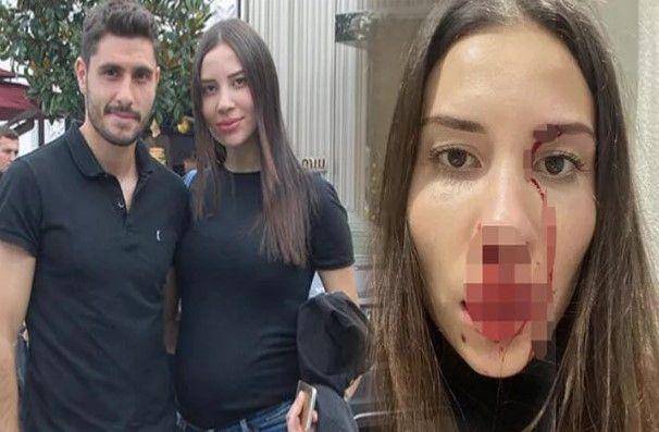 Eski futbolcu zer Hurmac ve iki ocuunun annesi Mihriban Hurmac arasndaki darp davasnn ilk durumas grld. stanbul 15. Asliye Ceza Mahkemesi'nde grlen ilk durumada, mteki sanklar zer Hurmac ile Mihriban Hurmac, taraf avukatlaryla hazr bulundu.