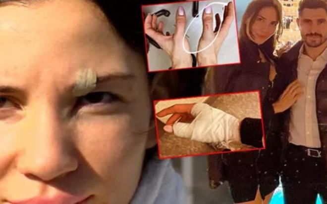 Birbirlerini darp ettikleri iddia edilen futbolcu zer Hurmac ile ei Mihriban Hurmac'nn yarglanmasna baland. lk celsede mtalaasn aklayan savclk, iki tarafn da 1,5 yla kadar hapisle cezalandrlmasn talep etti.