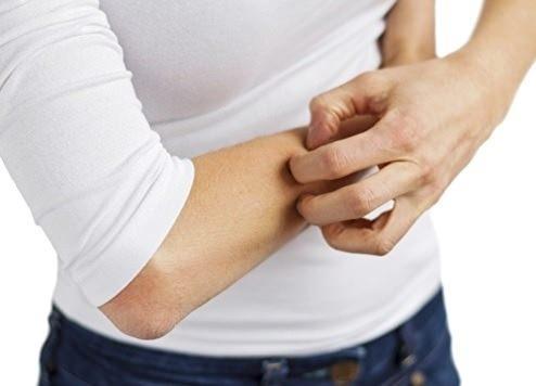 3-Yourt  <br>  1 ay ka beyaz sirke, 1 yemek ka un ve 2 yemek ka yourdu macun kvamna getirin. Karm kararan blgelere uygulayp 20 dakika boyunca bekletin. Bu yntemi haftada 3 kez uygulayabilirsiniz.