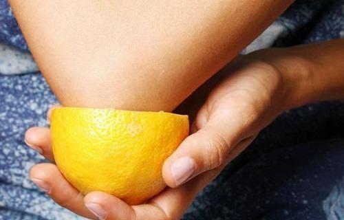 2-Limon  <br>  Limonun yarsn kesip dirseklerinize hafife masaj yaparak 20 dakika boyunca uygulayn. Su ile durulayabilirsiniz.