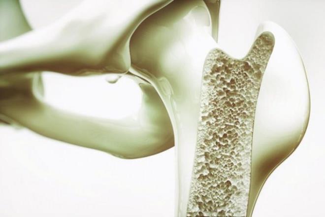 Dnyada da kemik salnda kullanlan formu kalsiyum karbonat tuzudur.