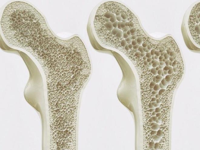 HANG KALSYUM TAKVYELER KULLANILMALI?    En iyi tolere edilen kemie ok yarar salayan elemental kalsiyum ierii yksek olan kalsiyum tuzlarndan biri olan kalsiyum karbonat kalsiyum takviyeleri ierisinde beslenme uzman olarak nerdiim deerli bir formudur.