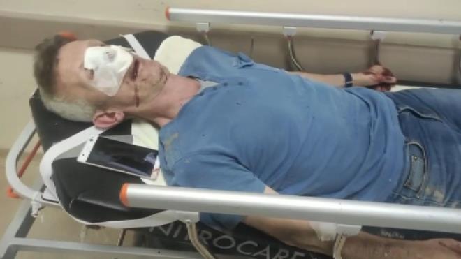 Bursa'nn Osmangazi ilesinde sitedeki fahi zam iin eylem yapan kii, ynetici tarafndan dvld.