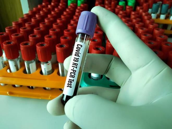 Dier taraftan, ABD Hastalk nleme ve Kontrol Merkezi (CDC) Bilimsel ve Endstriyel Aratrma Konseyi-Genomik ve Btnletirici Biyoloji Enstits'nden Lipi Thukral, Covid-19'un en son mutasyonunun Hindistan'daki birka farkl eyalette tespit edildiini ve dier varyantlardan daha hzl yaylyor gibi grndn syledi.