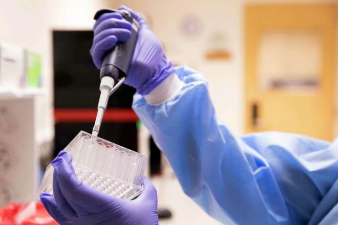 Bilim insanlarn korkutan yeni Omicron varyant: BA.2.75 alardan ve nceki baklktan kaabilir - 2  "HIZLI BR EKLDE YAYILDIININ ERKEN GSTERGES"    Konuya ilikin aklama yapan ABD?deki Mayo Clinic viroloji uzman Matthew Binnicker, ?Yeni varyantn, zellikle Hindistan'daki  bulama oranlarnda arta neden olduu grnyor. Ancak, varyanta ilikin pek ok konu henz belirsiz. Ancak, BA.2.75?in dnyann daha dk dzeyde virs gzetimine sahip blgelerinde tespit edilmesi, hzl bir ekilde yayldnn erken bir gstergesidir? diye uyard.