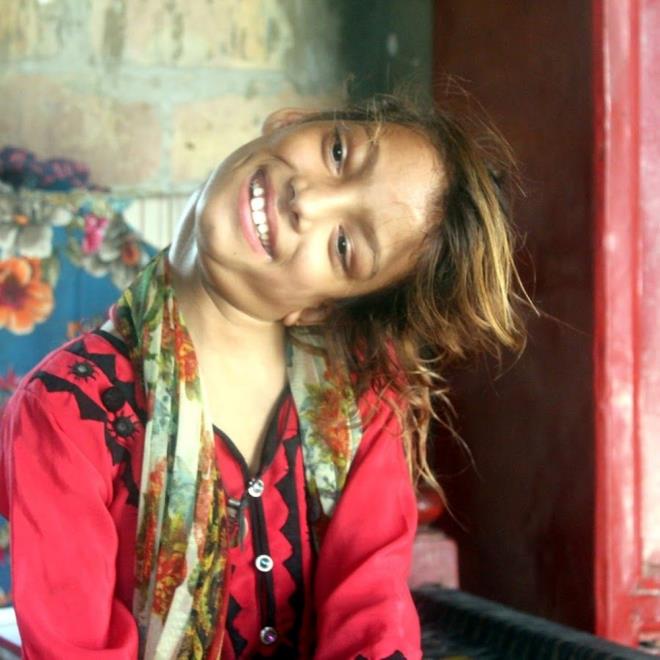 Hindistan'n Delhi kentindeki Apollo Hastanesi?nde karmak omurga ameliyatlar konusunda uzman olan Dr. Rajagopalan Krishnan, Afsheen'in ameliyatn cretsiz yapmay teklif etti.