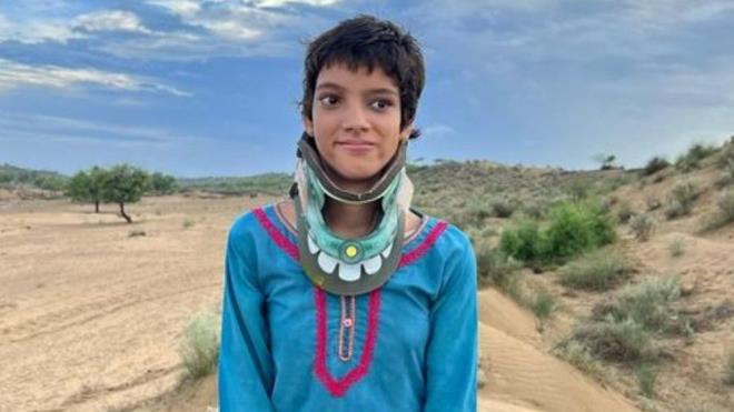 13 yandaki Afsheen'in annesi Jamilan Bibi, "Yryemiyor, yemek yiyemiyor veya konuamyordu. Yerde yatyordu ve biz de ona her konuda yardm ediyorduk. Daha fazla tedaviye paramz yetmedi" dedi.