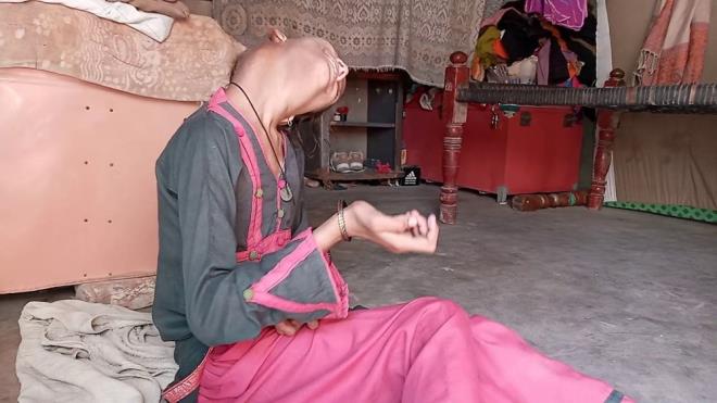 Afsheen'in kardei Yaqoob Kumbar ise "Biraz zayf ve hala okula gidemiyor.  Ancak doktor bunun zamanla iyileeceini sylyor. ok mutluyuz. Doktor kz kardeimin hayatn kurtard. Bizim iin o bir melek" diye konutu.     te yandan Afsheen iin, nl Pakistanl aktr Ahsan Khan, Facebook'ta Afsheen'in bir fotorafn paylaarak insanlar yardm etmeye arrken, Afsheen'in annesi lkedeki  popler bir sabah programna davet edildi. ABD'deki bir organizatr ise ailesinin ameliyat masraflarn karlamasna yardmc olmak iin evrimii bir ba kampanyas da oluturuldu.