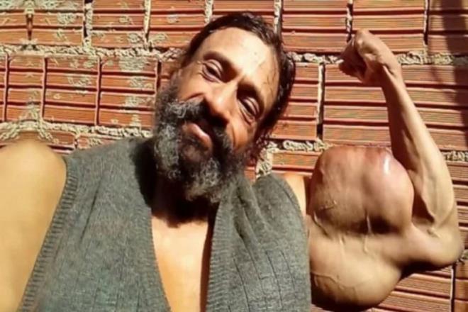 Da Silva, ardndan Segato?nun hastaneye kaldrldn ancak burada hayatn kaybettiini bildirdi.     te yandan, Segato?nun eskiden sska bir gen oldu,, ancak spor salonunda Synthol  teklif edildikten sonra maddeye baml hale geldii belirtildi.