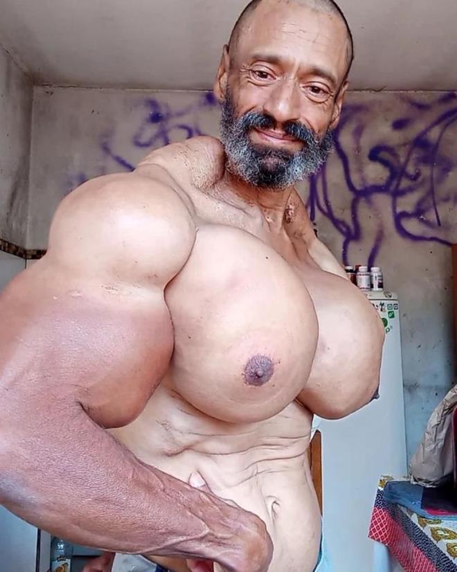 PAZILARININ GENL 60 SANTMETREYE IKTI    Kendisine Synthol enjekte etmeye baladktan sonra Seato?nun pazlarnn genilii 60 santimetreye kadar kt. Sokaklarda ?canavar? olarak anlmaya baladn aktaran vcut gelitirici, dnmnn grntlerini sosyal medyada yaynlad ve hatta Instagram'da kendisine ?Valdir Synthol? adn verdi.