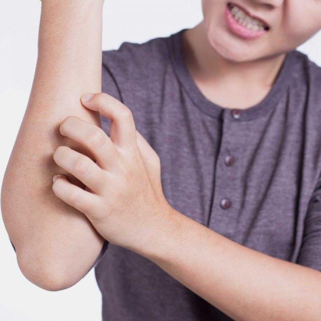 Acilleri dolduran bu vakalar konusunda uzmanlar kiilerin evlerini srekli havalandrarak ilalanmas gerektiini ve C vitamini arlkl beslenmenin neminin altn izdi.