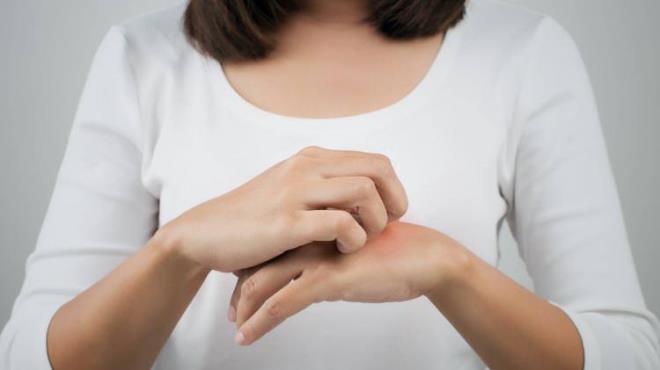 Srekli kanma cildi tahrip ederken kiide ayrca gribal semptomlar yaanr. Ba ars halsizlik ve kant en belirin belirtilerdir.