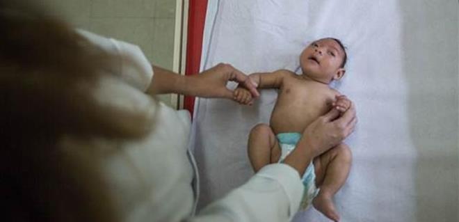 Zika virs 7 yl iinde Anadolu'ya yaylabilir. Uyar Halk Sal Genel Mdrl'ne bal Salk Tehditleri Erken Uyar ve Cevap Dairesi Bakanl'nn raporunda yer alyor.