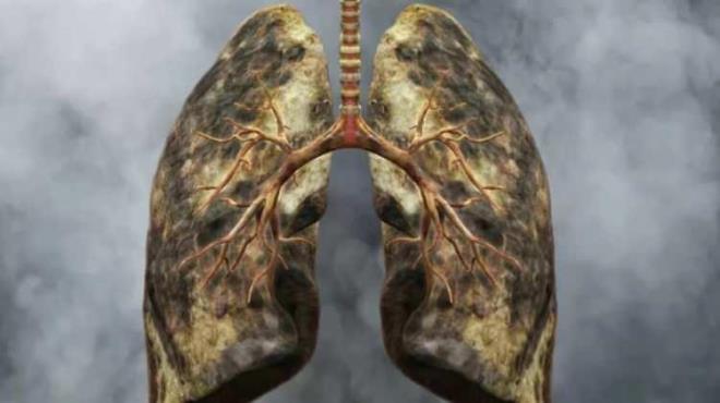 zellikle st solunum yollar hastalklarna davetiye karan akcierleirn hasar almamas iin uzmanlar baz besinler nerir.