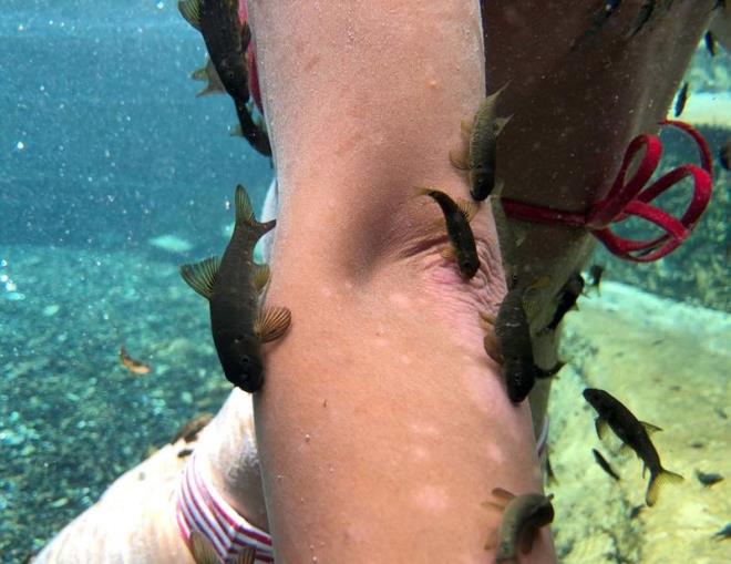 "Milyonlarca dolarmz baka lkelerdeki ila firmalarna gidiyor. Bu ilalarn byk ksm da kortizonlu. Dolaysyla insanlarn saln daha ok bozuyor. Bu memlekette maddi olarak gc yetmeyip buraya gelemeyenler de var. nallah zel statye alrlar ve insanlar rahat bir ekilde kaplcamza gelir, tedavi olur ve gider."